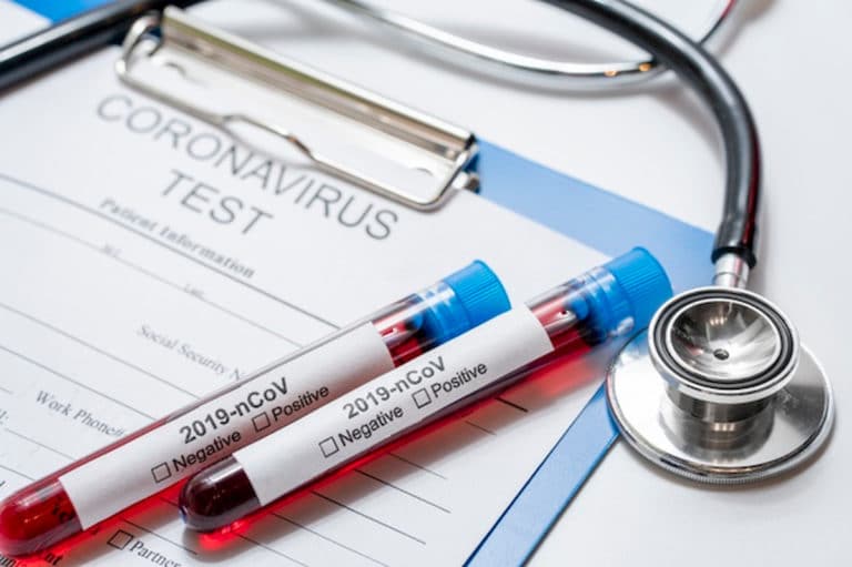 Ostatniej doby wykonano ponad 42,1 tys. testów na koronawirusa